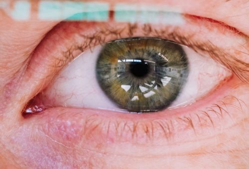Aura lays off 20% of workforce, rejigs C-suite amid R&D refocus on eye cancer